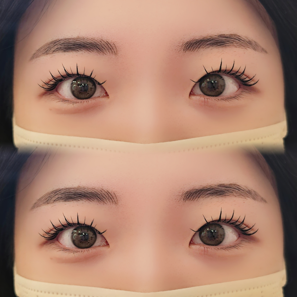 팔로우픽 - followPick 